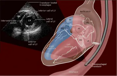 dioisofageios yperixokardiografiki meleti